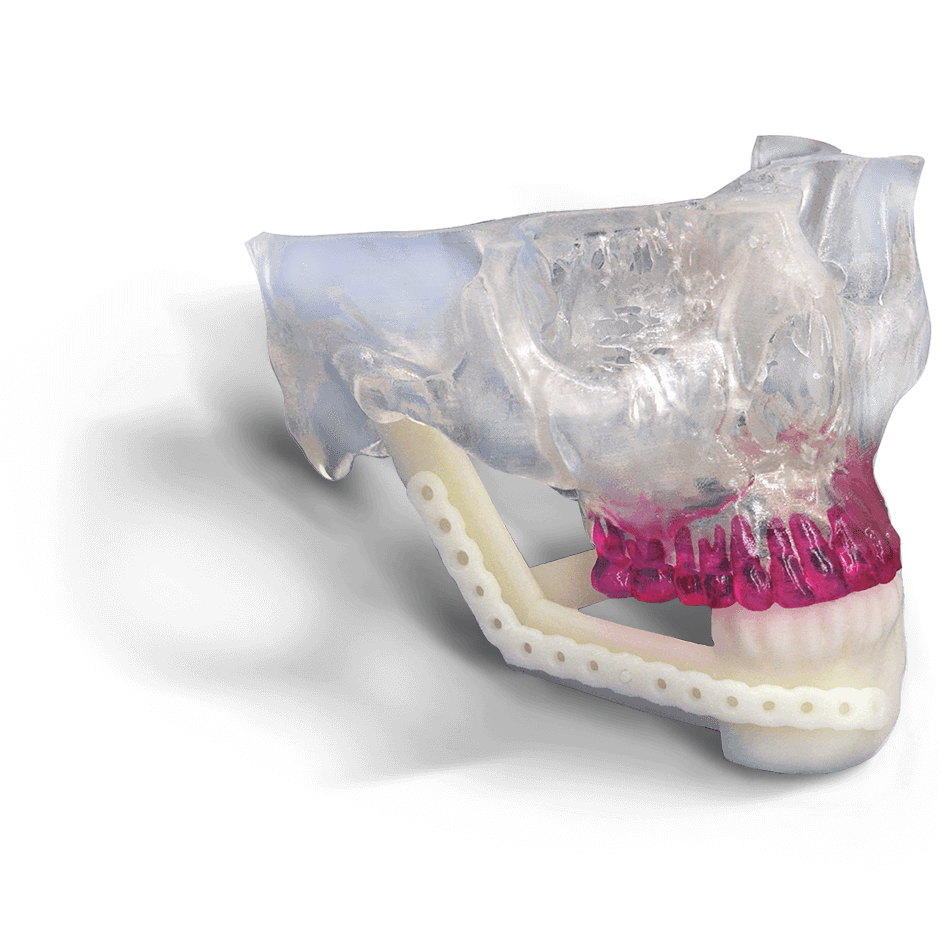 半透明塑料3d打印