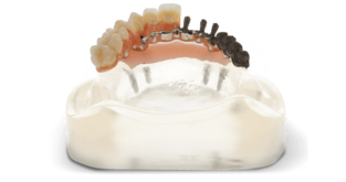 3d-systems-dental_hybrid-bridge-tn.png